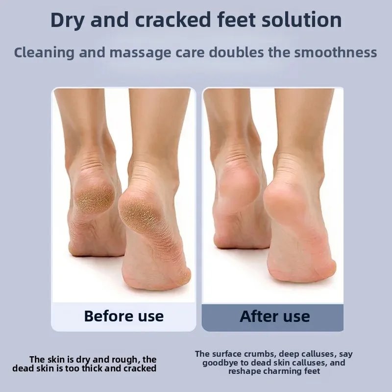 مبرد كعب القدم الإلكتروني - الصورة 3