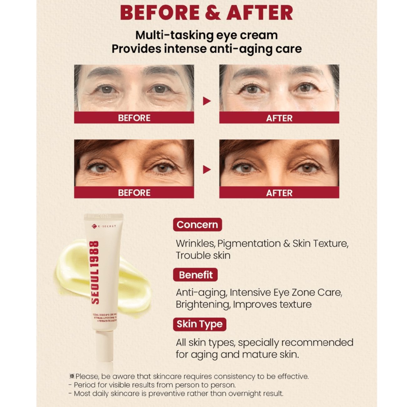 سيول 1988 كريم العيون بالريتينال الليبسومي 4% + حبوب مخمرة من كي سيكرت-30مل - الصورة 2