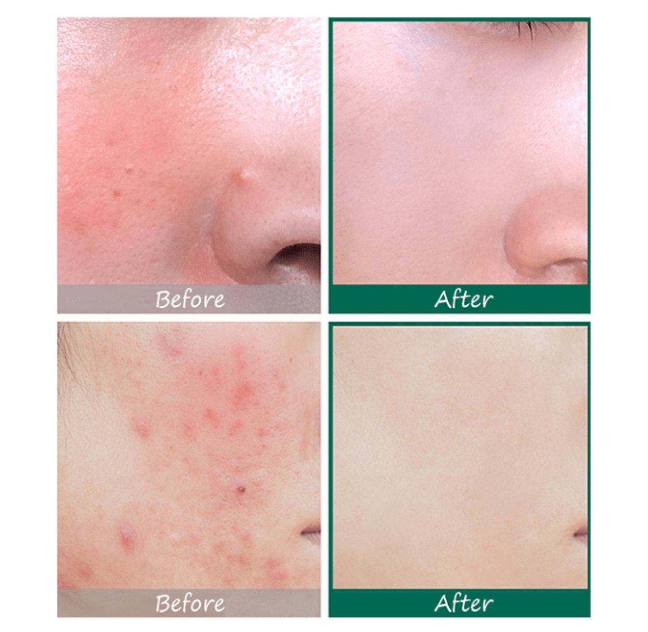 سيروم العناية AHA BHA PHA من سوم باي مي-50مل - الصورة 2