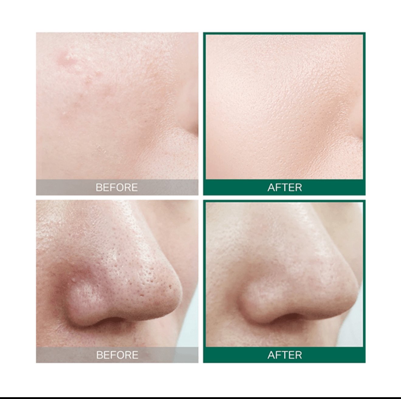 تونر العناية AHA BHA PHA من سوم باي مي-150مل - الصورة 2