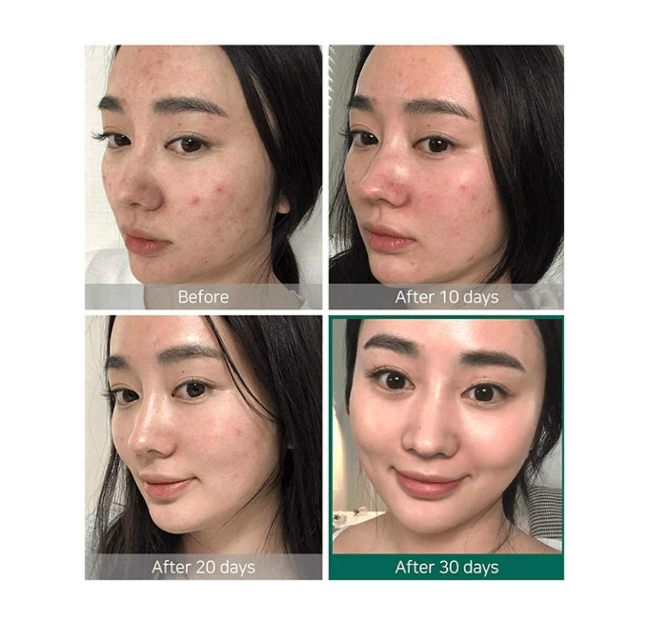 تونر العناية AHA BHA PHA من سوم باي مي-150مل - الصورة 3