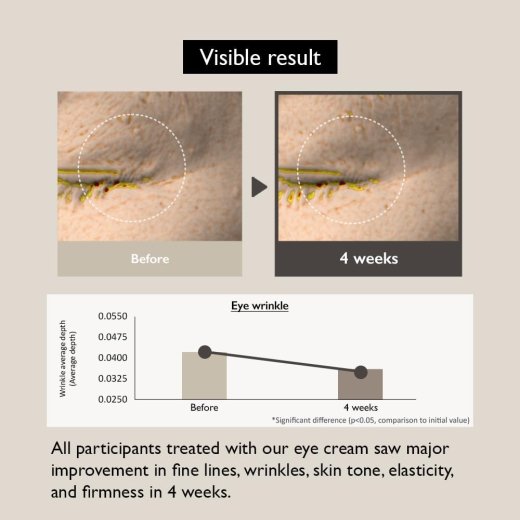 كريم العين بالباكوشيول والارز الاسود + الكولاجين والسيكا من هارو هارو وندر-20مل - الصورة 2